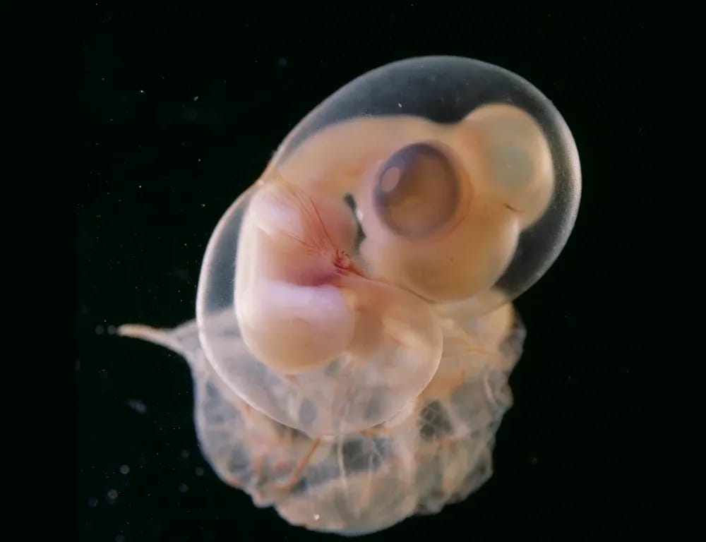 medium_lennart_nilsson2_e3e978abf9